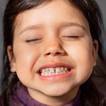 niña con manchas en los dientes